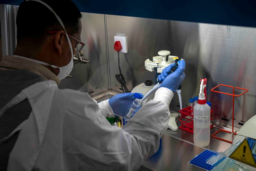 El Departamento de Salud solo añade una muerte por COVID-19 como confirmada si existe una prueba molecular positiva.