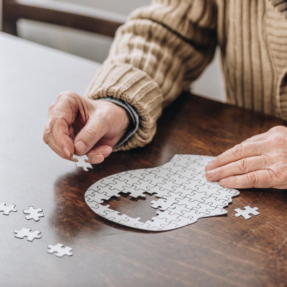 La pérdida de memoria es uno de los síntomas principales y más tempranos del Alzheimer.