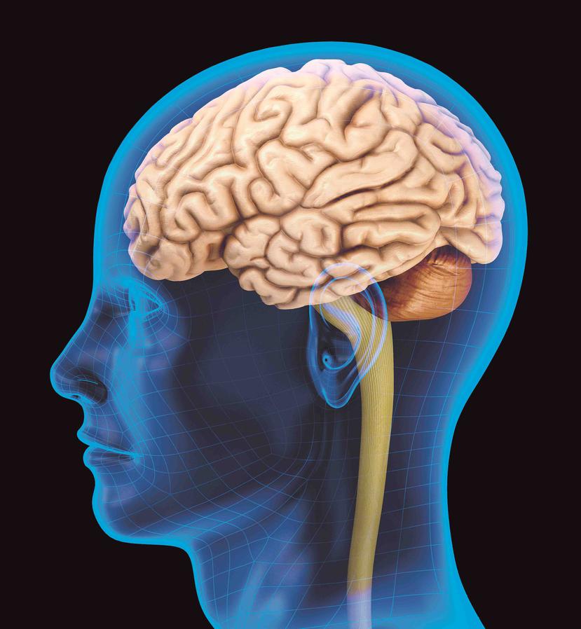 El Alzhéimer está asociado con la acumulación de la proteína Tau dentro de las células nerviosas del cerebro, así como con depósitos de proteínas beta-amiloides en el exterior de esas células. (Archivo)