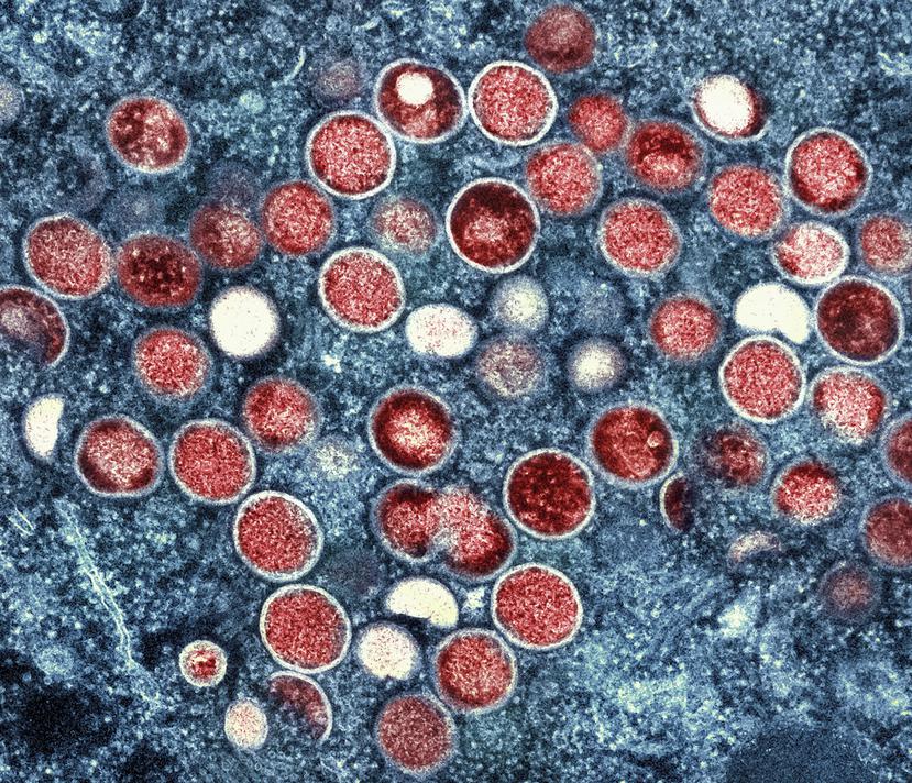 Una micrografía electrónica de transmisión coloreada de partículas de viruela del mono (rojas) encontradas dentro de una célula infectada (azul), cultivadas en el laboratorio en Fort Detrick, Maryland.