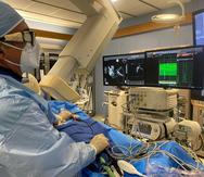 El doctor Miguel Abreu durante un procedimiento en el que utilizó CartoSound, una nueva herramienta que permite ver el corazón con exactitud mientras realizan un procedimiento cardiaco.