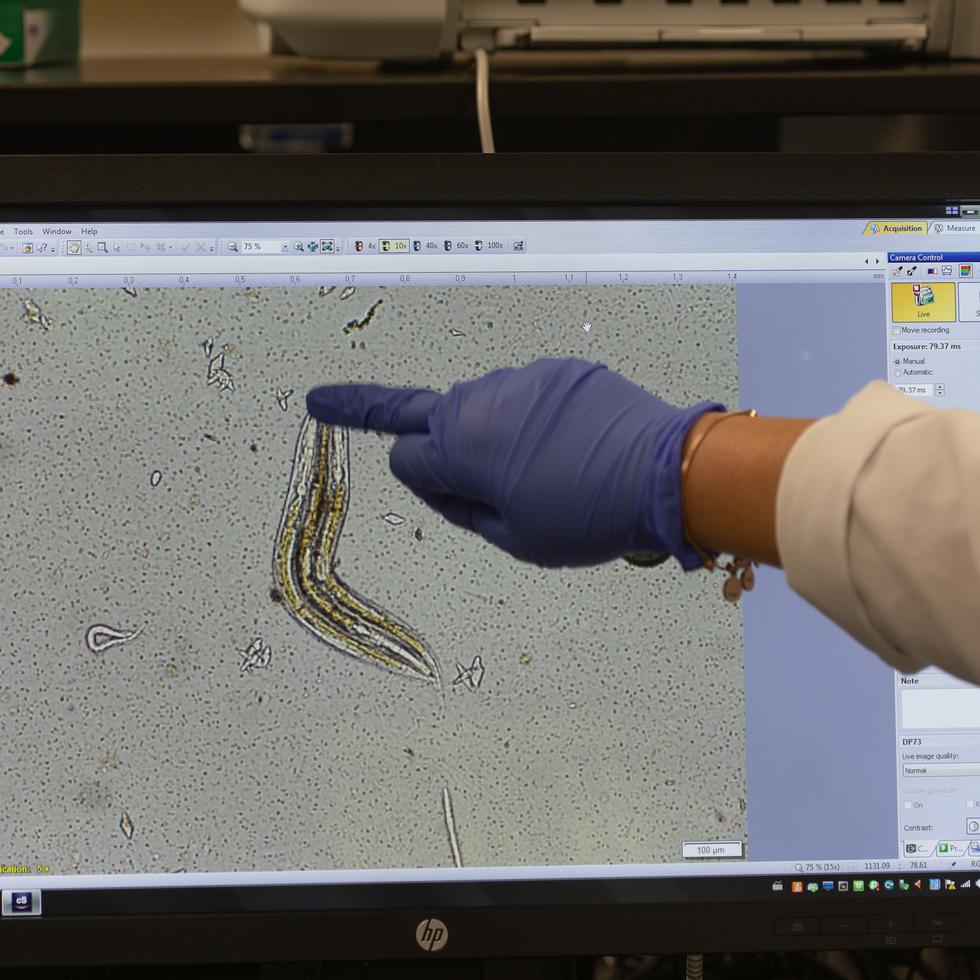 La estudiante Darielys Maldonado muestra en pantalla tres gusanos (uno al lado del otro) en el laboratorio, en la Universidad Católica en Ponce.