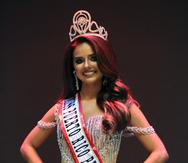 Para la Miss Puerto Rico Petite 2021, Yannina Ruiz Rosa, haberse desarrollado en la danza desde que era una niña, le haayudado a ser una mujer más madura, organizada y disciplinada.