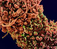 Los investigadores esperan que la famotidina afecte la replicación del coronavirus 2. (NIH Flickr)