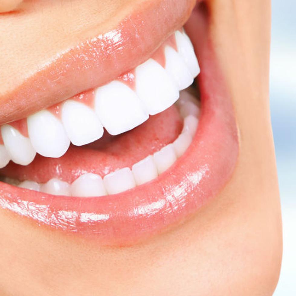 Expertos señalan que someter los dientes a un exceso de agentes blanqueadores puede provocar daños en los dientes.