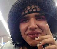 Alexa Negrón Luciano, también conocida como “Neulisa”, una mujer transgénero sin hogar, fue asesinada el 24 de febrero de 2020 en Toa Baja.