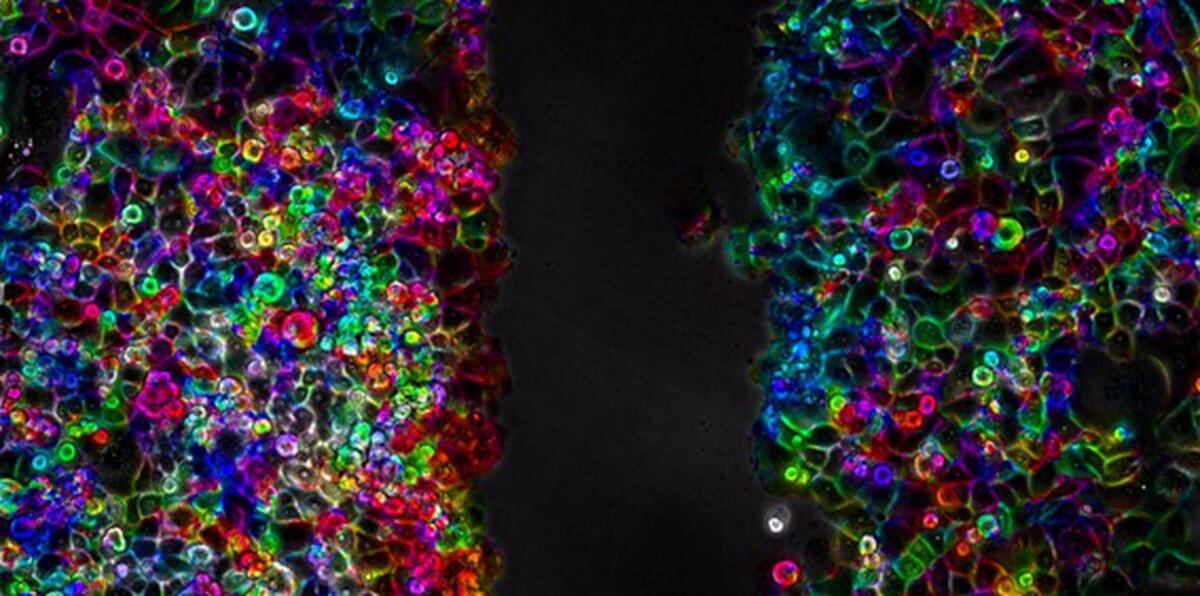 Células de cáncer de páncreas durante un proceso de migración celular. Imagen cedida por el Instituto de Tecnologías Físicas y de la Información Leonardo Torres Quevedo (ITEFI) del Consejo Superior de Investigaciones Científicas.
