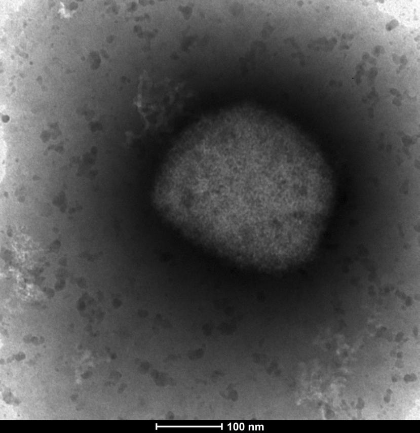 Esta imagen proporcionada por la Unidad de Microscopía Electrónica del ISCIII en Madrid, el 26 de mayo de 2022, muestra una imagen de microscopio electrónico del virus de la viruela de monos.