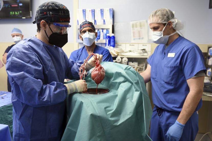 Unos médicos muestran un corazón de cerdo que fue trasplantado al paciente David Bennett en Baltimore.