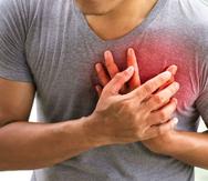 Un ataque cardíaco (o infarto agudo al miocardio) ocurre cuando se obstruye el flujo de sangre rica en oxígeno que llega a una parte del músculo cardíaco, evitando que el oxígeno llegue al corazón.