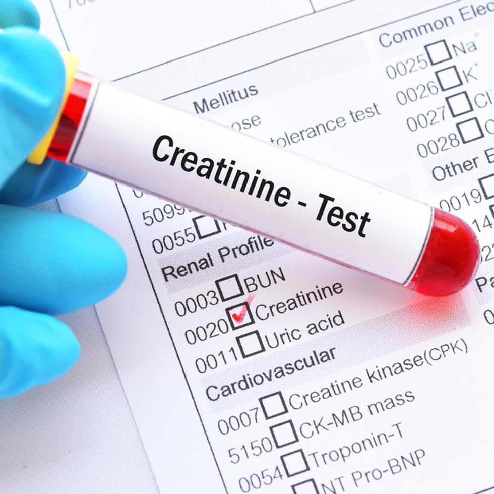 Uno de los parámetros utilizados para detectar enfermedad renal es la detección de la creatinina en la sangre.