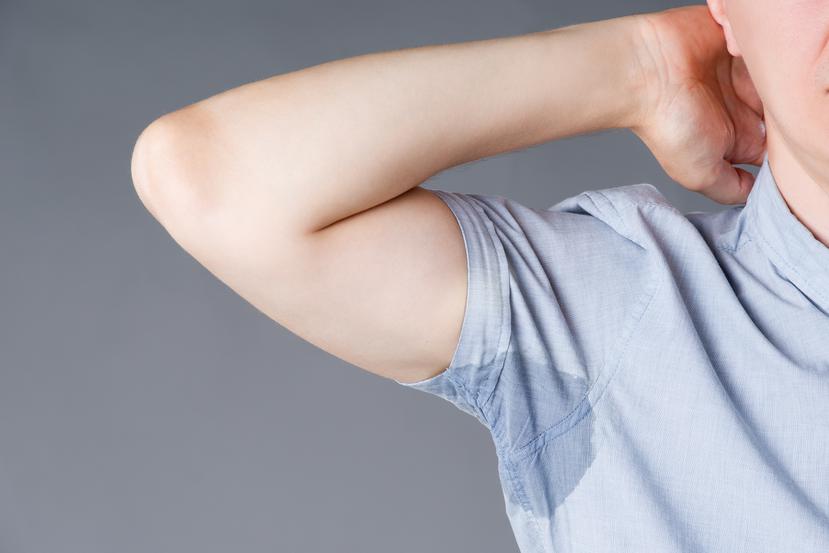 La hiperhidrosis afecta principalmente a hombres, pero las mujeres se sienten más presionadas por el sudor. (Shutterstock)
