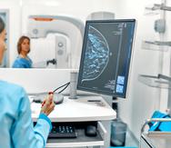 La mamografía consiste en una radiografía de los senos para detectar signos de cáncer de mama y el tejido mamario denso es uno de los factores que puede aumentar las probabilidades de que una mujer desarrolle cáncer.