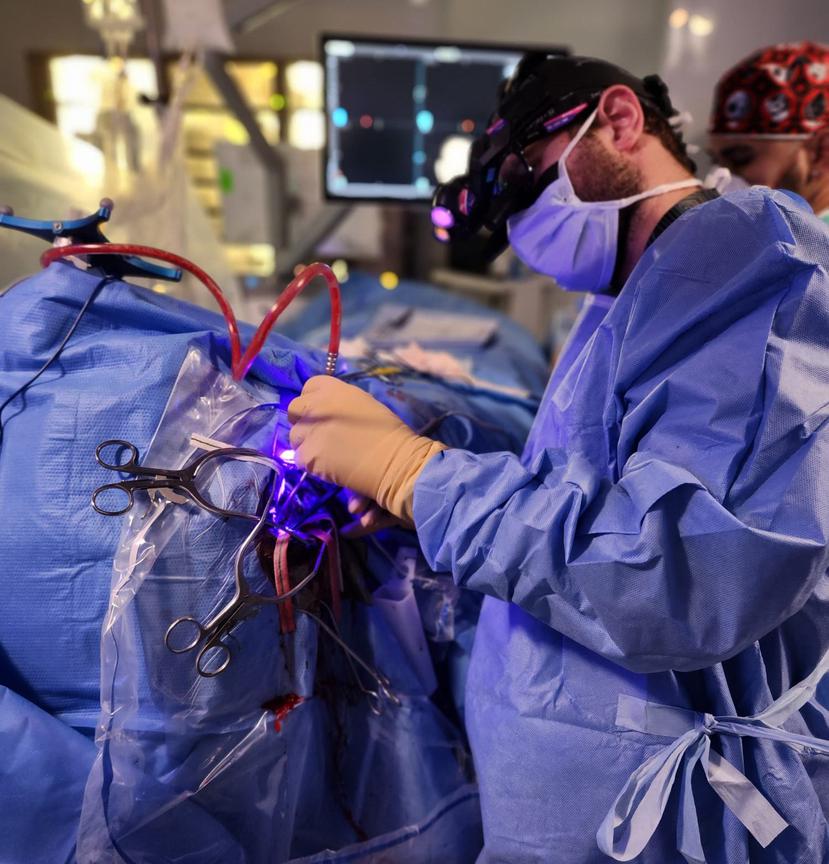 Durante la cirugía, el doctor Miguel A. Mayol usa la tecnología fluorescente conocida como Gleolan, que hace que las células cancerosas del cerebro se “enciendan”, lo que permite a los cirujanos ver y eliminar las células malignas durante la cirugía