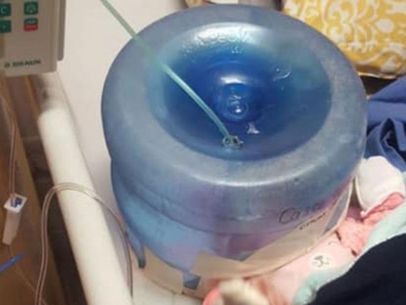 Los médicos improvisaron con un contenedor de agua una cámara cefálica. (Captura / Facebook)
