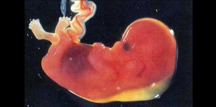 La exposición durante la vida fetal a contaminantes ambientales como los denominados disruptores endocrinos disminuye la fertilidad masculina durante al menos tres generaciones. (GFR Media)