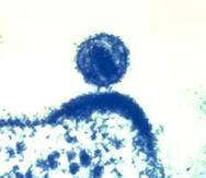 Esta imagen coloreada que fue captada con un microscopio electrónico en 2012, proporcionada por el Instituto Nacional de Enfermedades Alérgicas e Infecciosas de Estados Unidos (NIAID por sus siglas en inglés), muestra un virus de inmunodeficiencia humana, al centro, que brota de una célula inmunitaria a la que había infectado y dentro de la cual se había replicado.