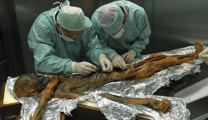 Los investigadores examinan el cuerpo de un cazador de hace 5.300 años conocido como Ötzi, el Hombre de Hielo (AP).