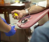 La FDA cambió el cuestionario para los posibles donanes de sangre al no hacer distinción de orientación sexual, sexo y género.