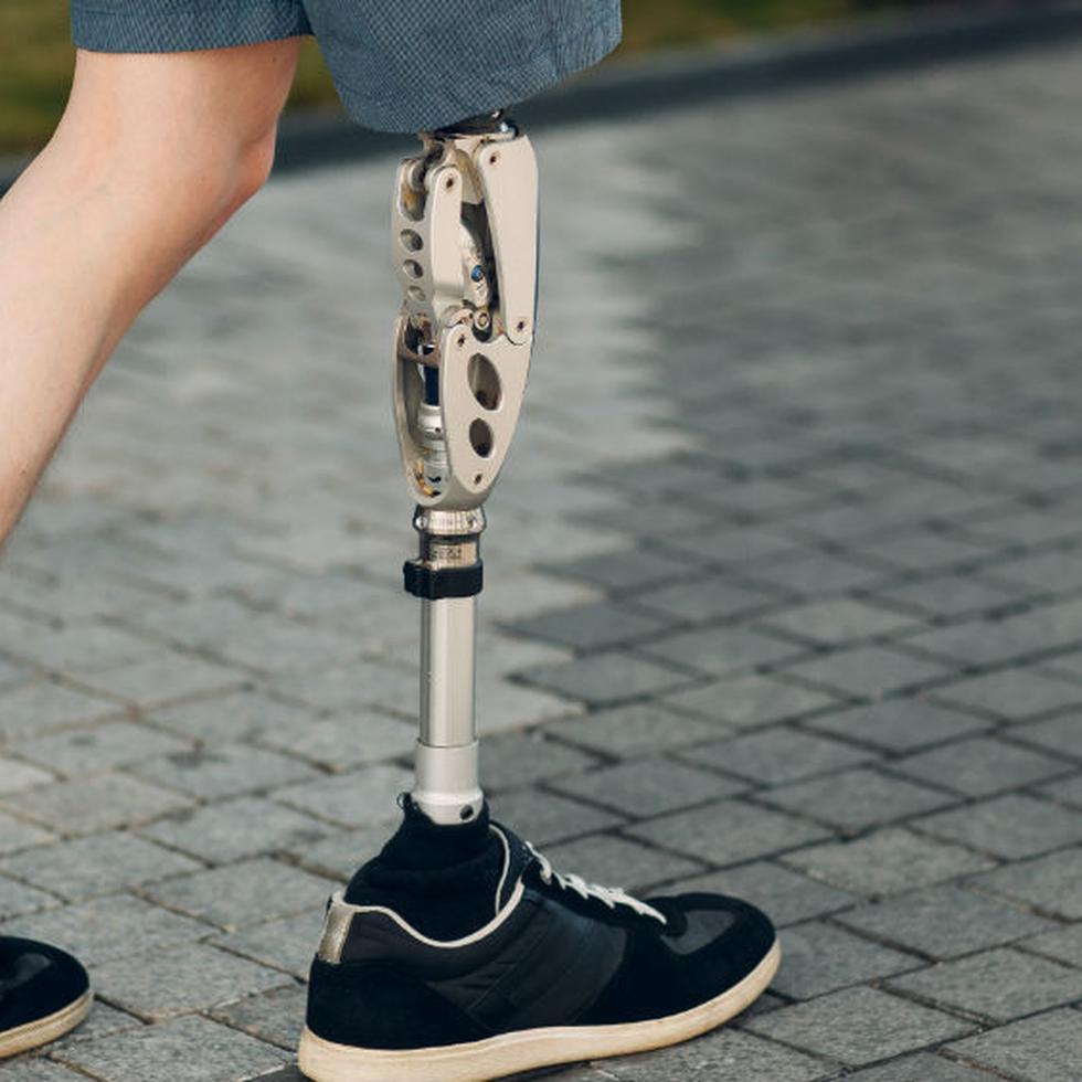 Muchos prefieren no usar de manera prolongada sus prótesis, debido a que consideran que no se ajusta a lo que debería ser su extremidad faltante.  (Shutterstock)