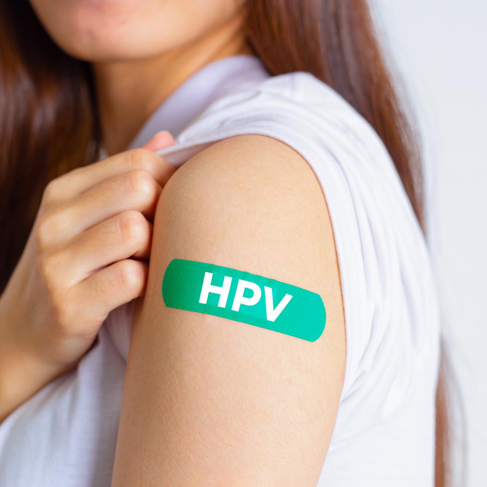 La vacuna contra el VPH puede prevenir la infección por los tipos de VPH más comunes que causan verrugas genitales y cáncer de cuello uterino.