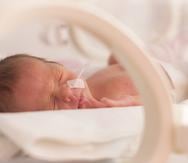 Cada año, unos 20.5 millones de bebés en el mundo nacen pesando menos de 5.5 libras. (Shutterstock)