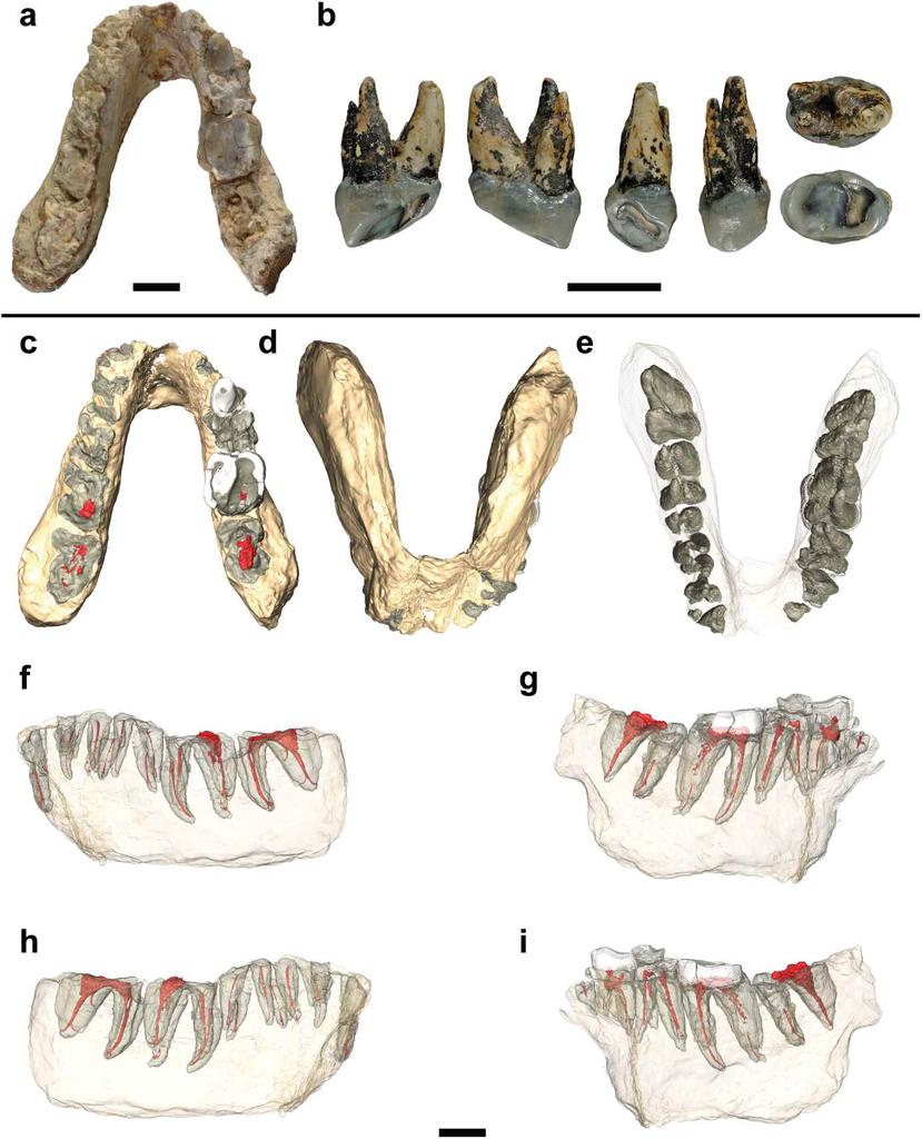 Los investigadores establecieron que dos fósiles (una mandíbula inferior descubierta en Grecia y un premolar superior en Bulgaria) pertenecen a prehumanos Graecopithecus freybergi que vivieron hace entre 7.24 y 7.17 millones de años. (journals.plos.org/pl