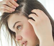 La nutrición es determinante para prevenir la caída difusa del cabello, problema al que los médicos llaman efluvio telógeno, que afecta más a mujeres. (Shutterstock)
