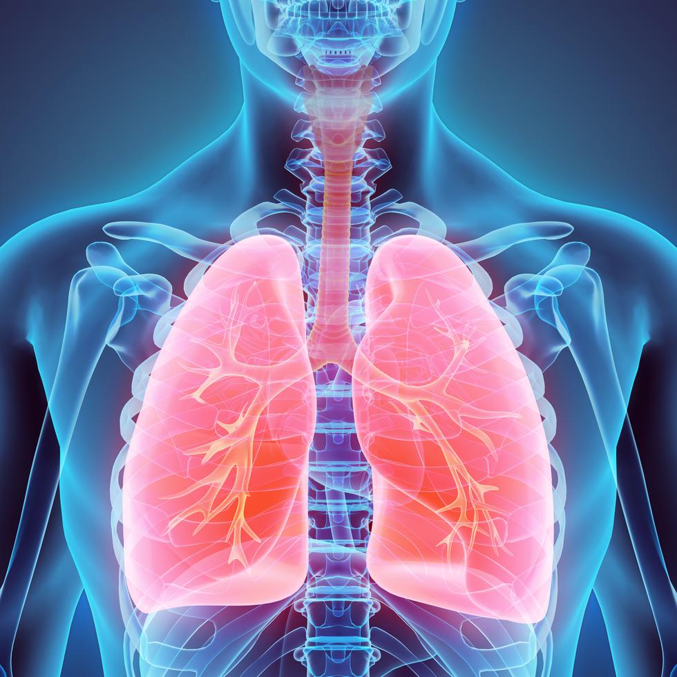 El cáncer de pulmón se origina en el mismo órgano y, a diferencia de otros tipos de cáncer, puede diseminarse a otros órganos como el cerebro y los ganglios linfáticos, con bastante rapidez.