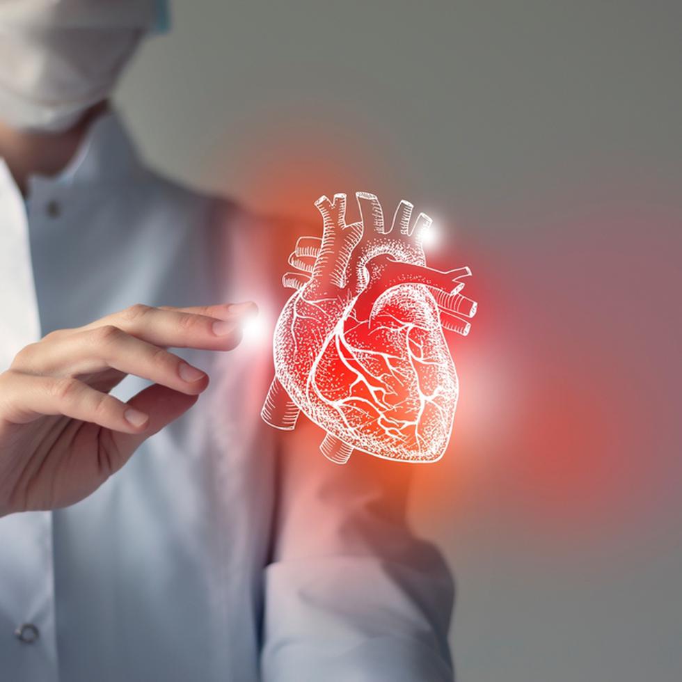La oclusión total crónica es el espectro más severo de enfermedad cardiaca ateroesclerótica en la que una arteria coronaria se identifica como completamente bloqueada.
