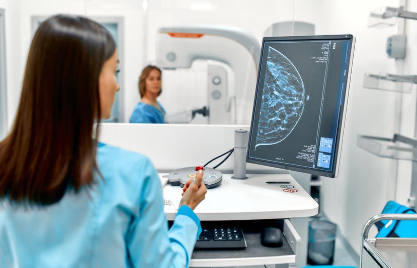 La mamografía consiste en una radiografía de los senos para detectar signos de cáncer de mama.