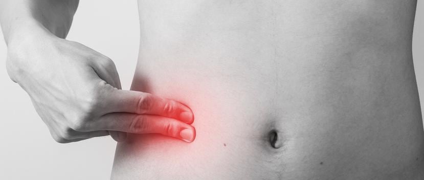 El dolor abdominal, que empieza en la parte superior, luego puede pasar a la zona alrededor del ombligo y, por último, se localiza en la parte inferior derecha. (Shutterstock)