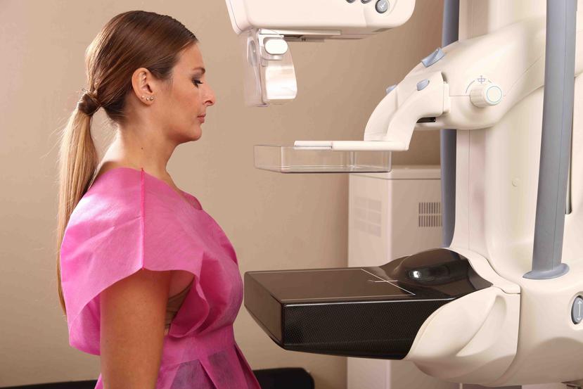 Toda aquella mujer que tenga síntomas sospechosos de cáncer de mama debe ir a un centro radiológico que preferiblemente sea fuera de un hospital. (Archivo)
