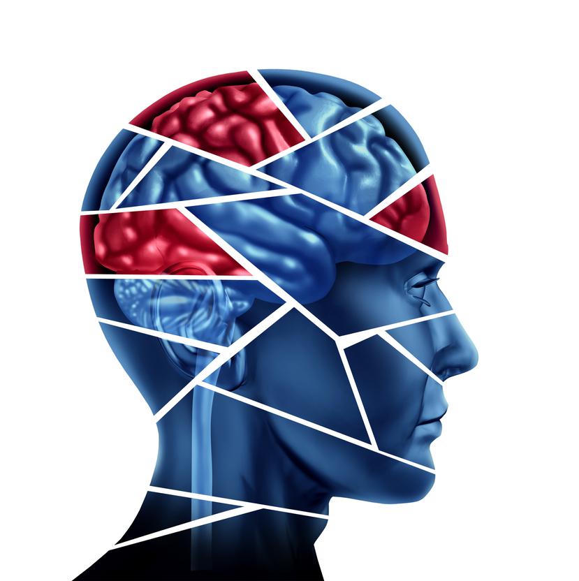 Cuando una zona específica del cerebro realiza una tarea determinada, aumenta el flujo sanguíneo en ella. (Shutterstock)
