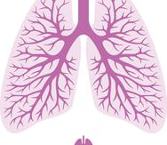 Conoce sobre la infección en el parenquima pulmonar