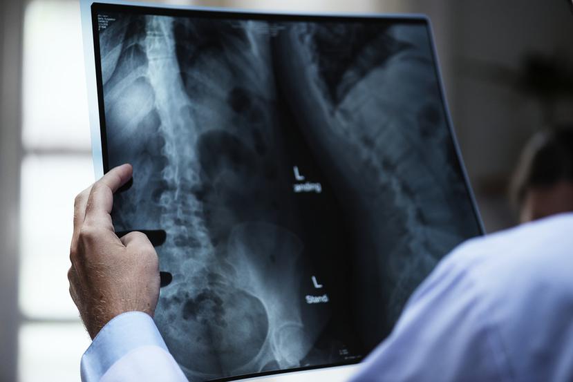 Los radiológos aseguran que la continuidad de servicios a los pacientes de la Reforma de Salud se pone en peligro con la negación por parte de las aseguradoras a pagar lo necesario. (Pixabay)