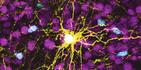 Esta imagen microscópica provista por Pasca Lab/Stanford Medicine muestra un astrocito humano, centro amarillo, y células gliales humanas (azul) dentro del cerebro de una rata. (Pasca Lab/Stanford Medicine via AP)
