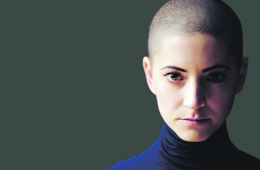La pérdida del cabello o alopecia no se presenta con todos los tratamientos contra el cáncer. (Shutterstock)