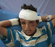 Un niño lesionado durante un bombardeo de la coalición encabezada por Arabia Saudí descansa en un hospital en Saná, Yemen. (AP/Hani Mohammed)