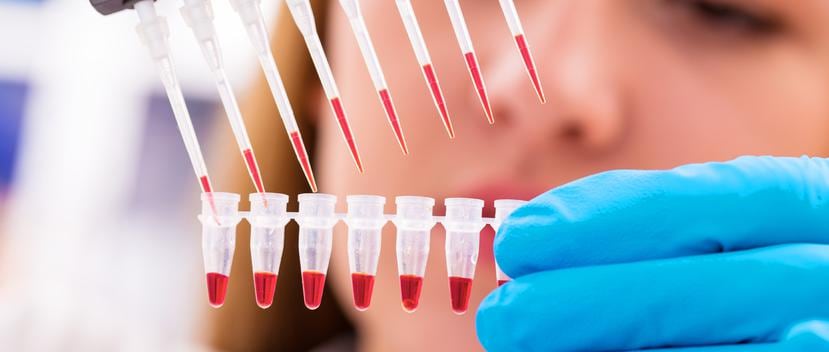 Se utilizaron células madre extraídas de grasas abdominales de los pacientes por liposucción y se inyectaron al pene de los pacientes. (Foto: Shutterstock)