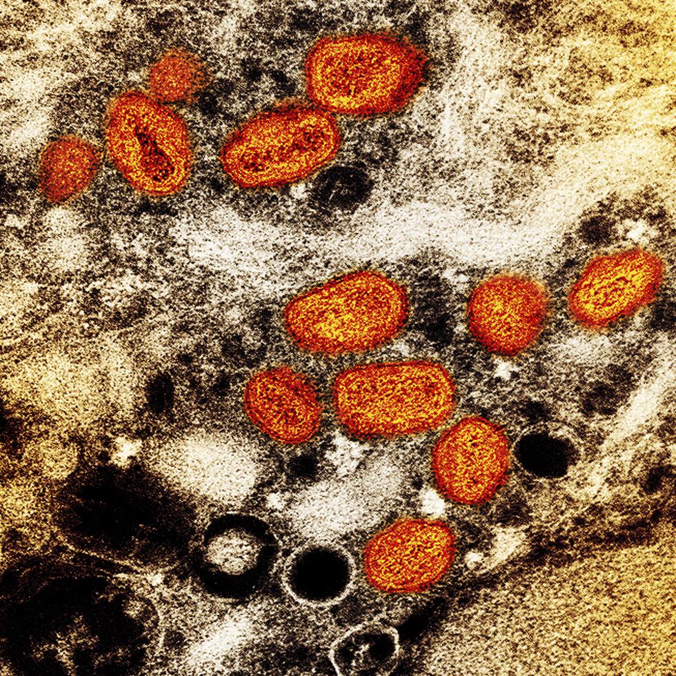 Esta imagen difundida por el Instituto Nacional de Alergias y Enfermedades Infecciosas de Estados Unidos muestra una imagen a color captada con un microscopio electrónico de barrido en el que se ven partículas de viruela símica, en anaranjado, encontradas dentro de una célula infectada (marrón) cultivada en un laboratorio. (NIAID via AP)