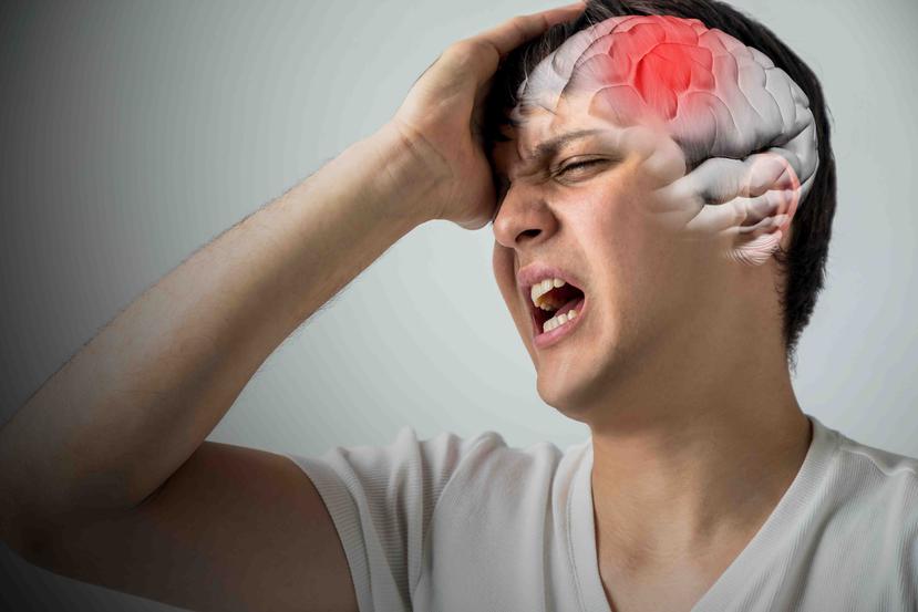 El accidente cerebrovascular como también se le conoce al ictus, es la segunda causa de muerte en la mayoría de los países de Latinoamérica. (Shutterstock)