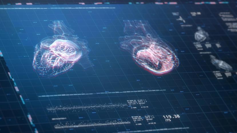 La tecnología del MRI cardíaco ayuda a identificar no solamente si el corazón está sufriendo de fallo cardíaco, sino también la razón.