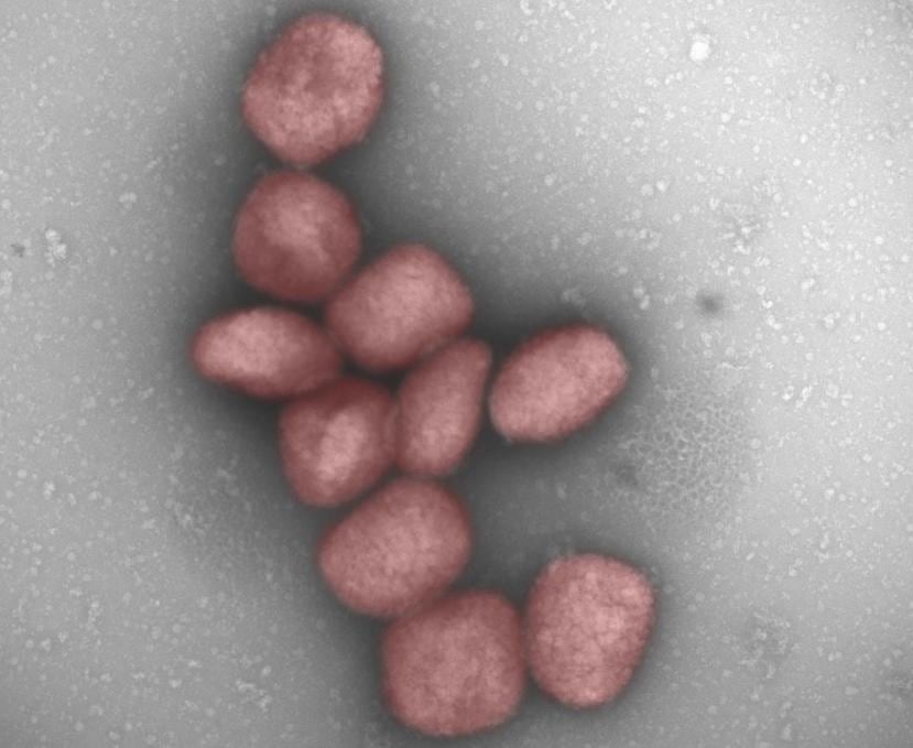 Partículas del virus de la viruela del mono teñidas de rojo en una fotografía facilitada por el Centro de Biología Molecular Severo Ochoa.