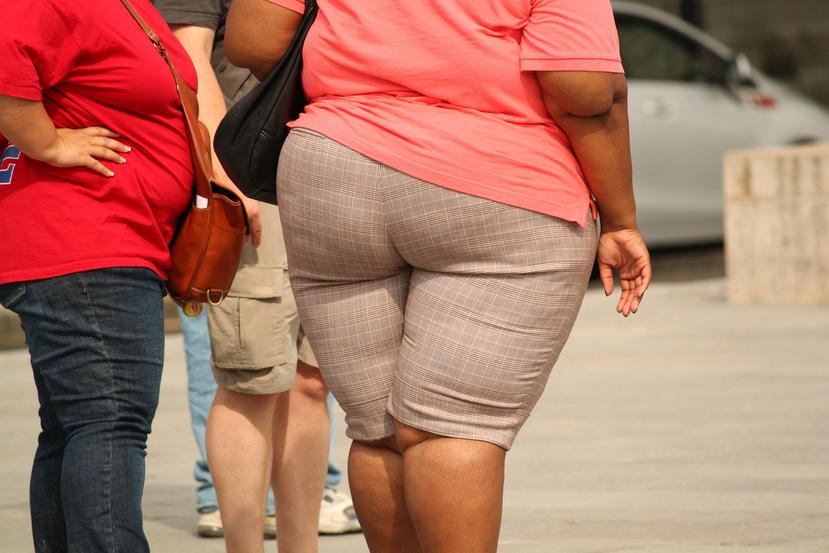 La obesidad produce un proceso inflamatorio en el organismo que afecta la inmunidad y facilita el riesgo de contraer otras enfermedades. (Pixabay)