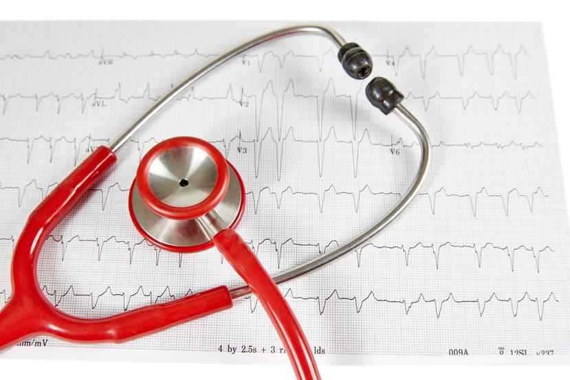 El cuidado de pacientes con insuficiencia cardíaca debe ser abordado de manera interdisciplinaria.