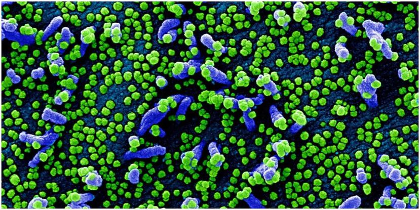 Imágenes de partículas dle coronavirus sobre una célula humana, tomadas con un microscopio electrónico y coloreadas en forma artificial. ( National Institute of Allergy and Infectious Diseases)
