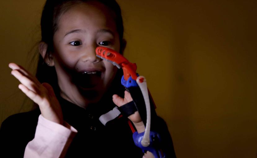 Usando los músculos de la muñeca para mover los dedos de plástico, la niña puede trabajar con cinta adhesiva y calcomanías en su clase de manualidades. (AP)
