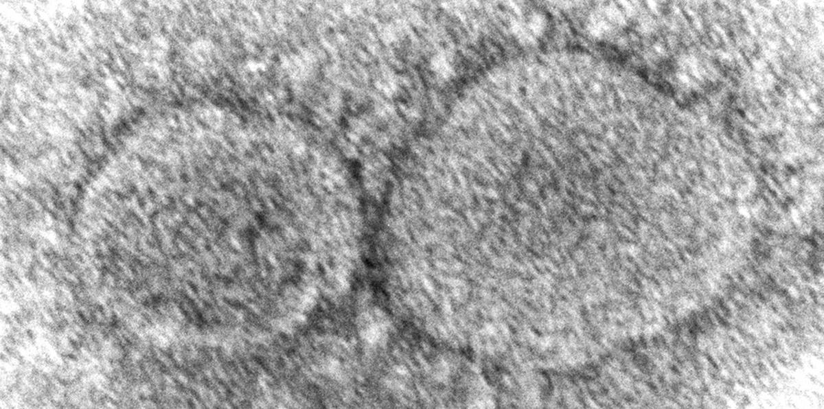 ARCHIVO - La imagen de microscopio electrónico de 2020 distribuida por los Centros de Control y Prevención de enfermedades muestra partículas de virus SARS-CoV-2, que causa COVID-19. La Cámara de Representantes votó por unanimidad el viernes 10 de marzo de 2023 hacer pública la información de los servicios de inteligencia estadounidenses sobre los orígenes del COVID-19, en una muestra de apoyo bipartidista en vísperas del tercer aniversario del inicio de la mortífera pandemia. (Hannah A. Bullock, Azaibi Tamin/CDC via AP, File)