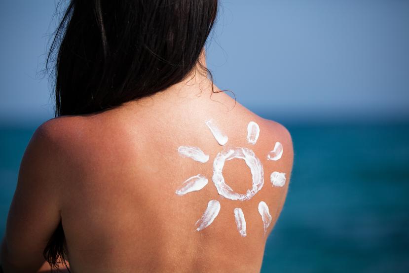 Una manera de prevención es conocer tu piel, identificar si existe algún cambio con la presencia de manchas, lunares y pecas. (Shutterstock)